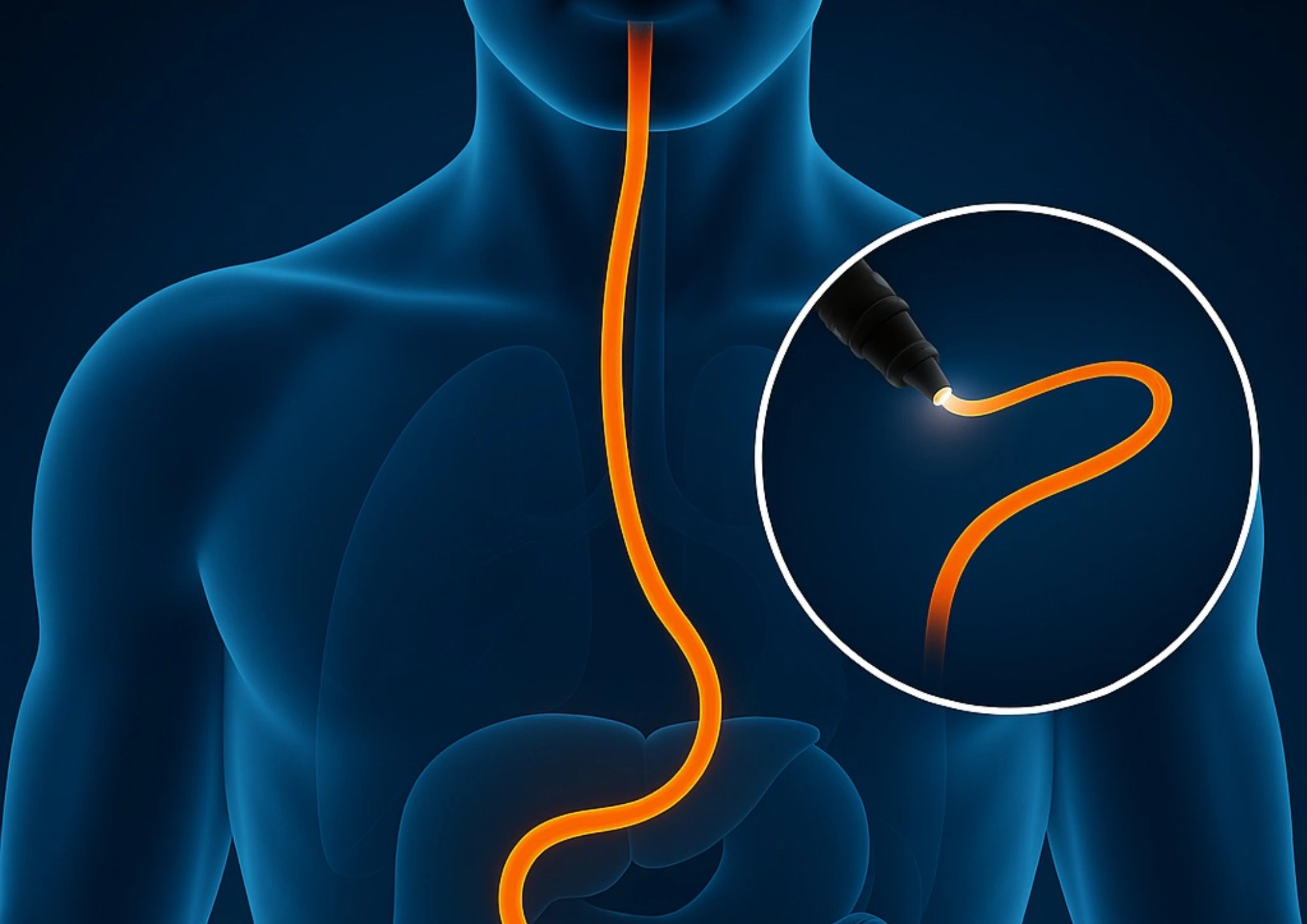 cabinet du dr marj-zohour haida - Endoscopie digestive à Béni Mellal